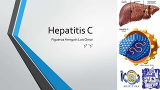 Hepatitis C
Figueroa Arreguín Luis Omar
5° “5”
 