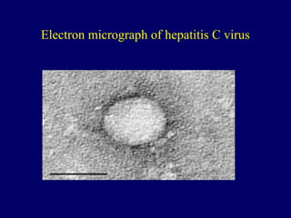 Electron micrograph of hepatitis C virus
 