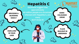 Hepatitis C
BRUISING &
BLEEDING
EASILY
SWELLING
IN YOUR
LEGS
FLUID
BUILDUP IN
ABDOMEN
DARK-
COLOURED
URINE
Estimates suggest that
approximately
40 million people are chronically
infected with Hepatitis C, and
many
don’t know it!
 