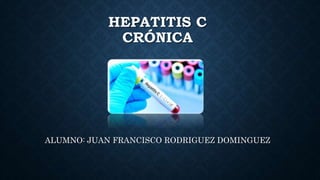 HEPATITIS C
CRÓNICA
ALUMNO: JUAN FRANCISCO RODRIGUEZ DOMINGUEZ
 