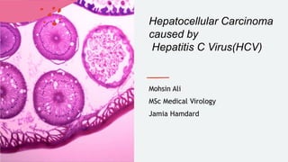 Hepatocellular Carcinoma
caused by
Hepatitis C Virus(HCV)
Mohsin Ali
MSc Medical Virology
Jamia Hamdard
 