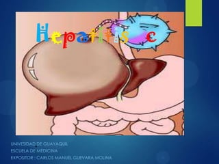 Hepatitis c



UNIVESIDAD.DE GUAYAQUIL
ESCUELA DE MEDICINA
EXPOSITOR : CARLOS MANUEL GUEVARA MOLINA
 