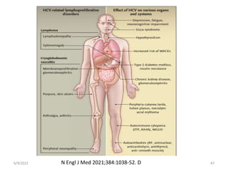 6/9/2022 47
N Engl J Med 2021;384:1038-52. D
 
