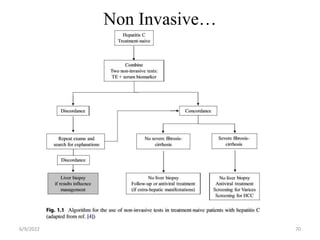 Non Invasive…
6/9/2022 70
 