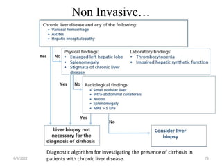 Non Invasive…
6/9/2022 73
Diagnostic algorithm for investigating the presence of cirrhosis in
patients with chronic liver disease.
 