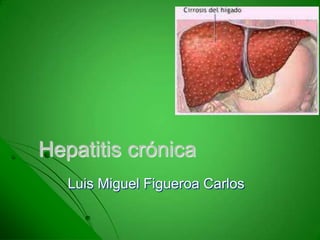 Hepatitis crónica
Luis Miguel Figueroa Carlos
 