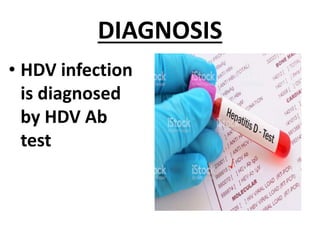 DIAGNOSIS
• HDV infection
is diagnosed
by HDV Ab
test
 