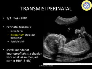 TRANSMISI PERINATAL
• 1/3 infeksi HBV
• Perinatal transmisi:
– Intrauterin
– Intrapartum atau saat
persalinan
– Setelah lahir
• Meski mendapat
imunoprofilaksis, sebagian
kecil anak akan menjadi
carrier HBV (3-4%)
dr. Aldika Akbar SpOG
 