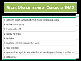 REGLA MNEMOTÉCNICA: CAUSAS DE IHAG
 