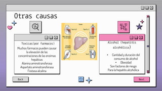 Otras causas
Toxicas(por farmacos)
Muchos fármacos pueden causar
la elevación de las
concentraciones de las enzimas
hepáticas
Alanina aminotransferasa
Aspartato aminotransferasa
Fostasa alcalina
Alcohol (hepatitis
alcohólica)
• Cantidad y duración del
consumo de alcohol
• Obesidad
Son factores de riesgo
Para la hepatitis alcohólica
Back Next
 