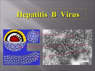 Hepatitis B VirusHepatitis B Virus
 