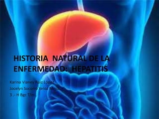 HISTORIA NATURAL DE LA
ENFERMEDAD: HEPATITIS
Karina Vianey Ruiz López
Jocelyn Socorro Veloz Mejía
3 .- H Bgc T/m
 
