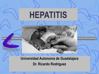HEPATITIS
Universidad Autonoma de Guadalajara
Dr. Ricardo Rodriguez
 