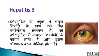 Hepatitis in hindi | PPTX