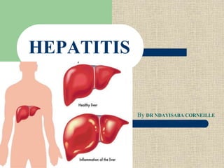 HEPATITIS
By DR NDAYISABA CORNEILLE
 