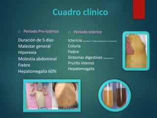 Cuadro clínico
 Periodo Pre-ictérico
Duración de 5 días
Malestar general
Hiporexia
Molestia abdominal
Fiebre
Hepatomegalia 60%
 Periodo Ictérico
Ictericia (pico Max. 5-15 días, desaparece en 5 semanas)
Coluria
Fiebre
Síntomas digestivos (desaparecen)
Prurito intenso
Hepatomegalia
 