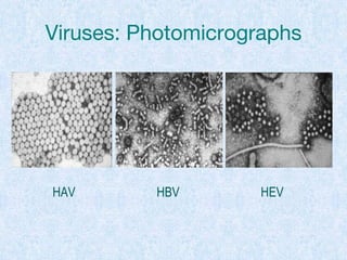 Viruses: Photomicrographs
HAV HBV HEV
 