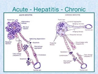 Acute - Hepatitis - Chronic
 