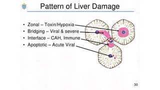 Acute and chronic Hepatitis MBBS second year .pptx