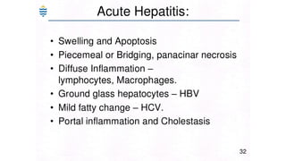 Acute and chronic Hepatitis MBBS second year .pptx