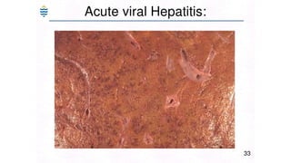 Acute and chronic Hepatitis MBBS second year .pptx