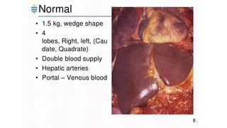 Acute and chronic Hepatitis MBBS second year .pptx