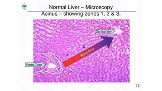 Acute and chronic Hepatitis MBBS second year .pptx