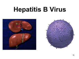 16
Hepatitis B Virus
 