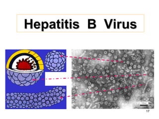 17
Hepatitis B VirusHepatitis B Virus
 