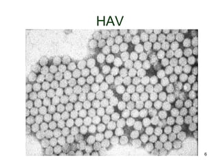 6
HAV
 