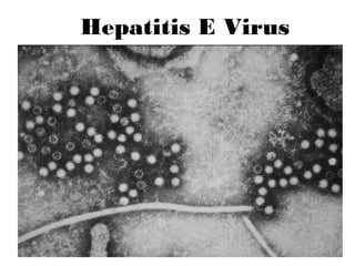 68
Hepatitis E Virus
 