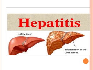 Hepatitis presentation | PPTX