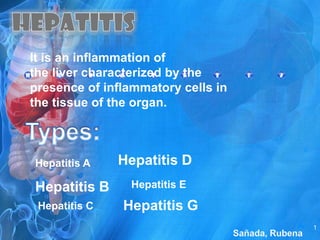 Hepatitis It is an inflammation of the liver characterized by the presence of inflammatory cells in the tissue of the organ. Types: Hepatitis D Hepatitis A Hepatitis B Hepatitis E Hepatitis G Hepatitis C 1 Sañada, Rubena 