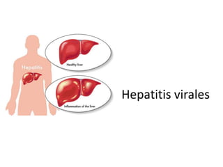 Hepatitis virales
 
