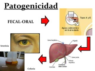 Patogenicidad
FECAL-ORAL
Coluria
Ictericia
 