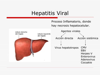 Hepatitis Viral Proceso Inflamatorio, donde  hay necrosis hepatocelular.  Agentes virales  Acción directa Acción sistémica Virus hepatotropos CMV EBV Herpes V Enterovirus Adenovirus Cocsakie 