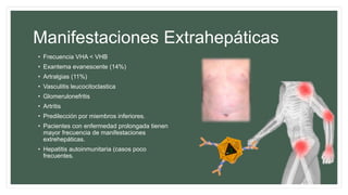 Manifestaciones Extrahepáticas
• Frecuencia VHA < VHB
• Exantema evanescente (14%)
• Artralgias (11%)
• Vasculitis leucocitoclastica
• Glomerulonefritis
• Artritis
• Predilección por miembros inferiores.
• Pacientes con enfermedad prolongada tienen
mayor frecuencia de manifestaciones
extrehepáticas.
• Hepatitis autoinmunitaria (casos poco
frecuentes.
 