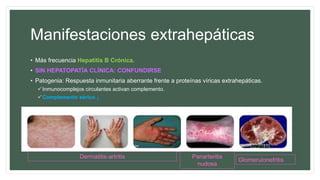 Manifestaciones extrahepáticas
• Más frecuencia Hepatitis B Crónica.
• SIN HEPATOPATÍA CLÍNICA: CONFUNDIRSE
• Patogenia: Respuesta inmunitaria aberrante frente a proteínas víricas extrahepáticas.
Inmunocomplejos circulantes activan complemento.
Complemento sérico ↓
Dermatitis-artritis Panarteritis
nudosa
Glomerulonefritis
 
