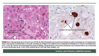 orceína, azul Victoria y aldehído fucsina
 