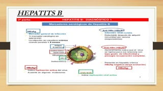 HEPATITS B
• El VHB produce un exceso de antígenos de superficie de virus:
HBsAg (Antígeno de superficie) – Primer marcador serológico
• Aparece entre la 1ra semana y 10ma semana después de la exposición
• Entre la 2da y 8va semana antes de la aparición de la hepatitis
• Permanece en la fase aguda y desaparece en la fase tardía de
convalecencia
• Si no desaparece a los 6 meses: Portador crónico de HBsAg
• La sangre en fase aguda o crónica no debe ser usada en transfusiones
 