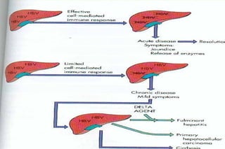 Major
 eterminants of
acute and chronic
  HBV infection
 