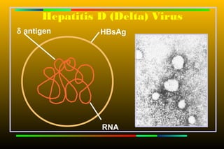 Hepatitis D (Delta) Virus
δ antigen       HBsAg




                RNA
 