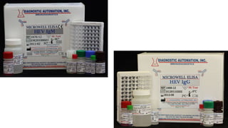Hepatitis viruses a &amp; e