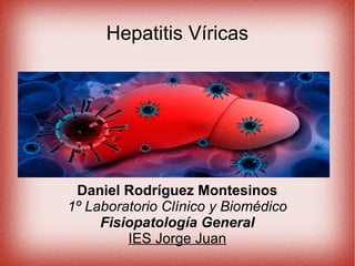 Hepatitis Víricas
Daniel Rodríguez Montesinos
1º Laboratorio Clínico y Biomédico
Fisiopatología General
IES Jorge Juan
 