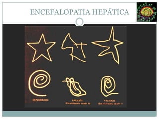 La captación hepática.