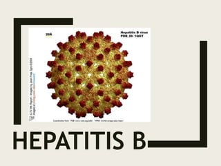 HEPATITIS B
 