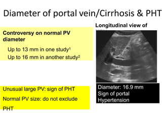 Hepato portal doppler ultrasound | PPTX