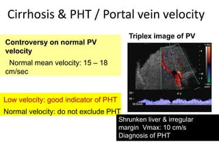 Hepato portal doppler ultrasound | PPTX