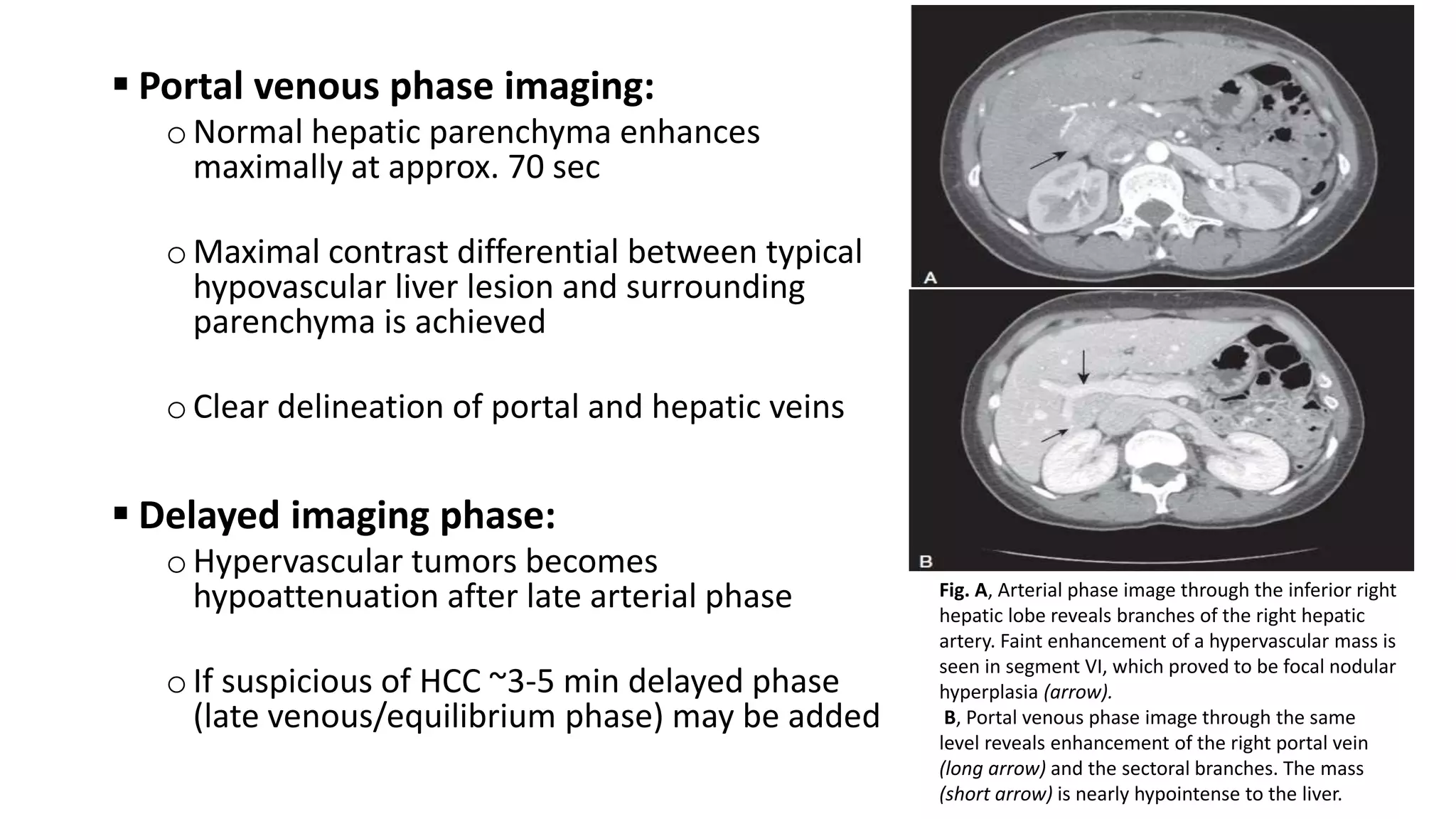 Hepatobiliary Imaging.pptx