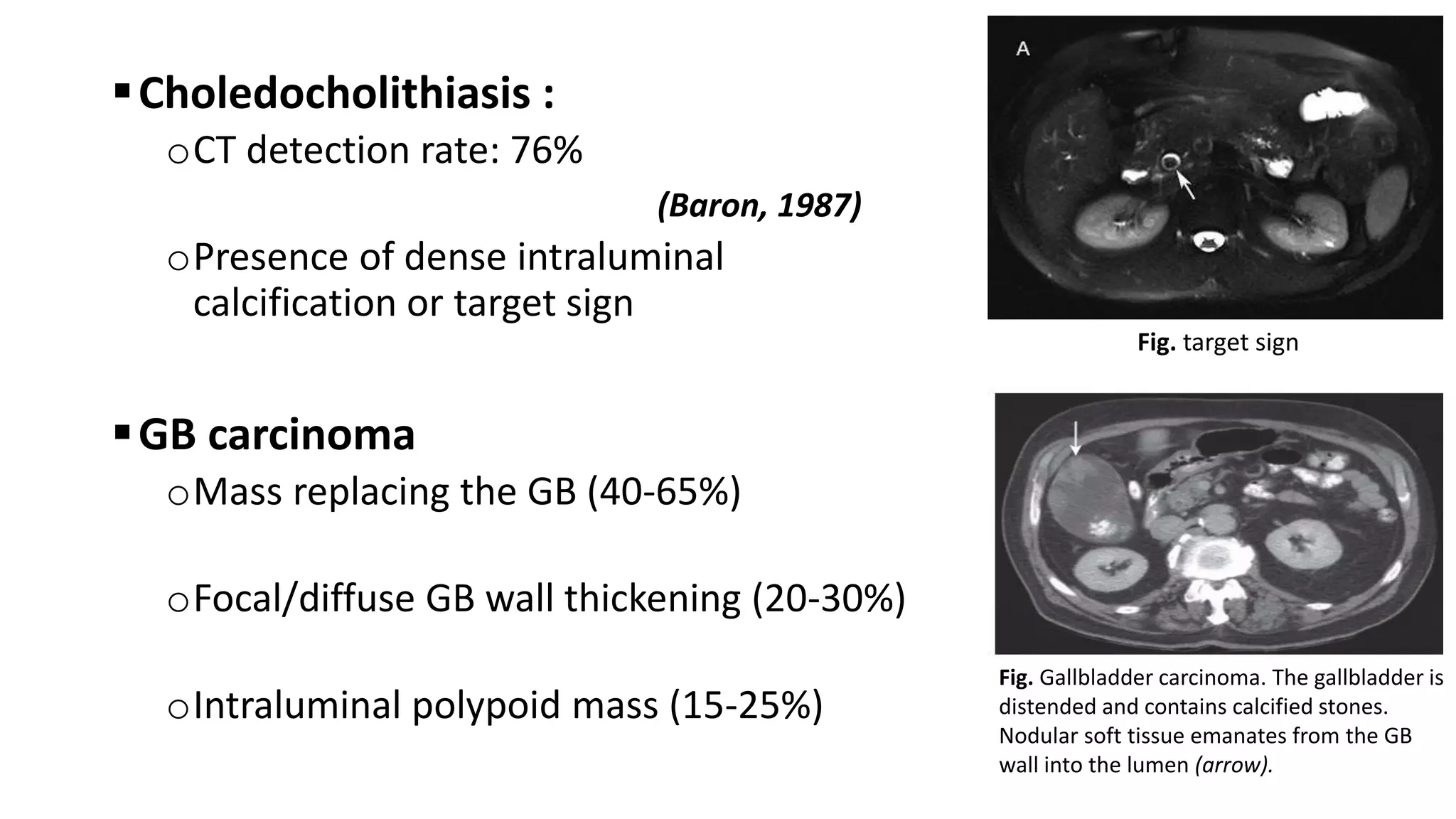 Hepatobiliary Imaging.pptx